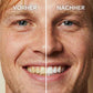 Tooth Polish - Instant Clean Smile