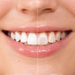 Tooth Polish - Instant Clean Smile
