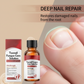 💅🌟 Nail Repair Essence – Rinforza &  Rigenera le unghie danneggiate in 7 giorni! ✨💪 Risultati visibili, dermatologicamente testati. La soluzione per unghie forti e sane.